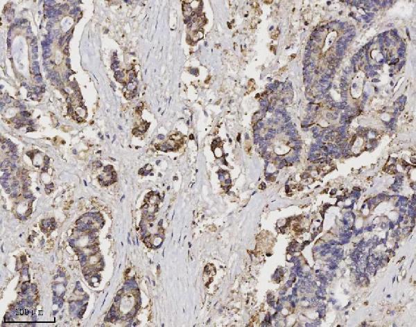  IHC analysis of Annexin A3 using anti-Annexin A3 antibody (M04796-2)