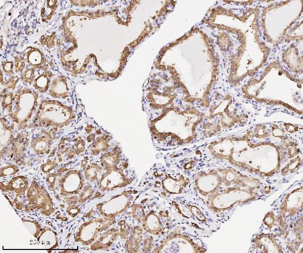 m04796 2 anxa3 primary antibodies ihc testing 4