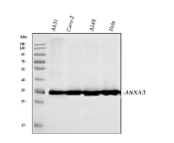  Western blot analysis of Annexin A3 using anti-Annexin A3 antibody (M04796-2)