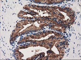 m04796 anti annexin a3 anxa3 mouse monoclonal antibody clone id oti1a5 ihc testing 4