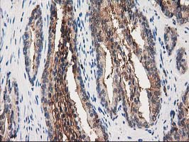 m04796 anti annexin a3 anxa3 mouse monoclonal antibody clone id oti1a5 ihc testing 5