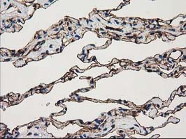 m04796 anti annexin a3 anxa3 mouse monoclonal antibody clone id oti1a5 ihc testing 6