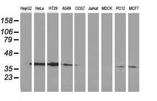 m04796 anti annexin a3 anxa3 mouse monoclonal antibody clone id oti1a5 wb testing 2