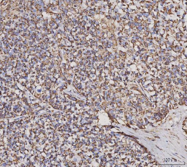 m04803 1 mdh2 primary antibodies ihc testing 2