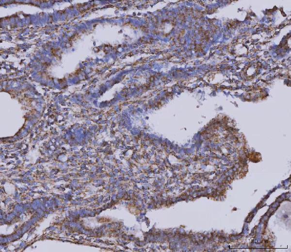 m04803 1 mdh2 primary antibodies ihc testing 3