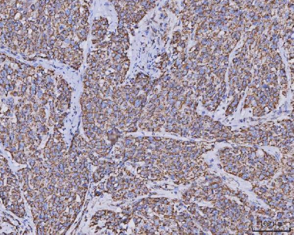 m04803 1 mdh2 primary antibodies ihc testing 4