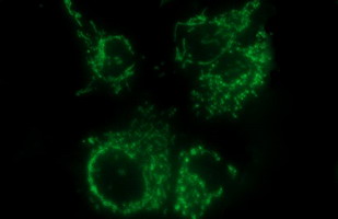 m04806 anti mt mcat mouse monoclonal antibody clone id oti2b7 if testing 3
