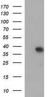 m04806 anti mt mcat mouse monoclonal antibody clone id oti2b7 wb testing 1
