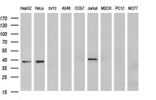 m04806 anti mt mcat mouse monoclonal antibody clone id oti2b7 wb testing 2
