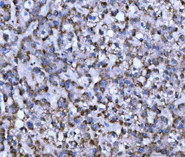  IHC analysis of WDR1 using anti-WDR1 antibody (M04814-1)