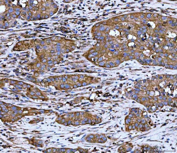  IHC analysis of WDR1 using anti-WDR1 antibody (M04814-1)