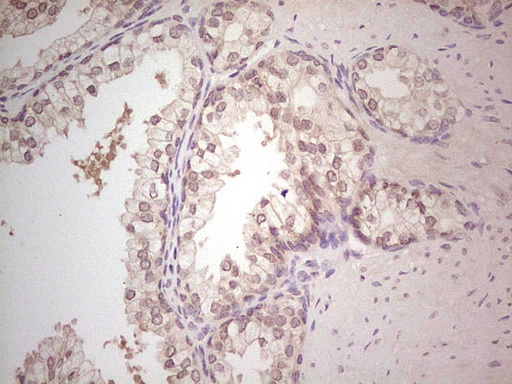 Immunohistochemical staining of paraffin-embedded Human prostate tissue within the normal limits using anti-HR mouse monoclonal antibody