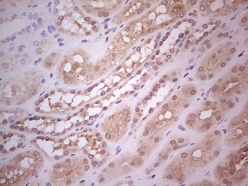 m04817 anti hairless hr mouse monoclonal antibody clone id oti1d9 ihc testing 4