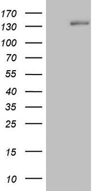 HEK293T cells were transfected with the pCMV6-ENTRY control (Left lane) or pCMV6-ENTRY HR (Right lane) cDNA for 48 hrs and lysed