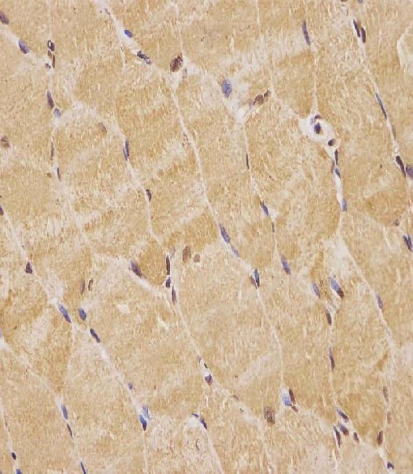 M04850-1 staining TK1 in human skeletal muscle tissue sections by Immunohistochemistry (IHC-P -paraformaldehyde-fixed, paraffin-embedded sections)