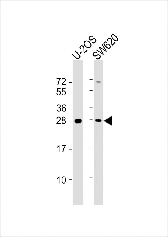 All lanes : Anti-TK1 Antibody (Center) at 1:2000 dilutionLane 1: U-2OS whole cell lysateLane 2: SW620 whole cell lysateLysates/proteins at 20 µg per lane