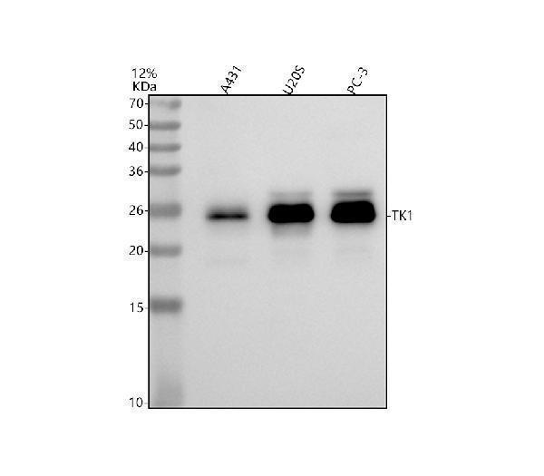 m04850 tk1 primary antibodies wb testing 1