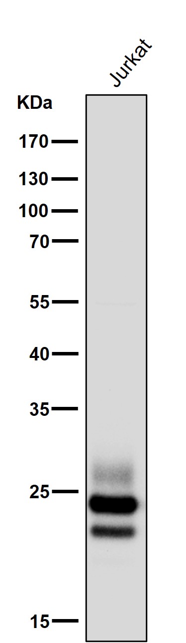 All lanes use the Antibody at 1:5K dilution for 1 hour at room temperature