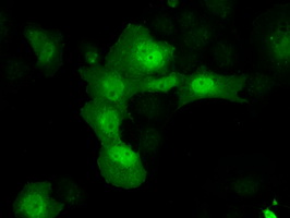 m04855 anti akr1a1 mouse monoclonal antibody clone id oti6e3 if testing 6