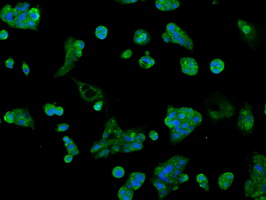 m04855 anti akr1a1 mouse monoclonal antibody clone id oti6e3 if testing 7