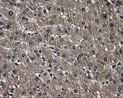 Immunohistochemical staining of paraffin-embedded liver tissue within the normal limits using anti-AKR1A1mouse monoclonal antibody