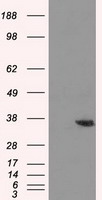 HEK293T cells were transfected with the pCMV6-ENTRY control (Left lane) or pCMV6-ENTRY AKR1A1 (Right lane) cDNA for 48 hrs and lysed