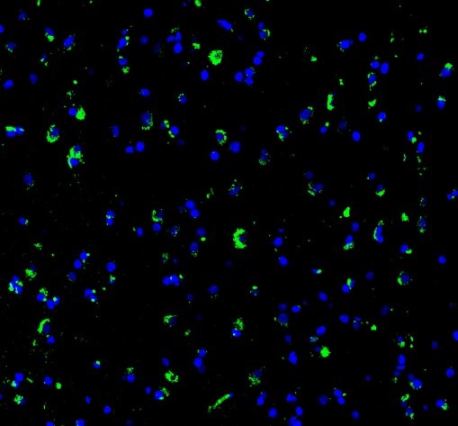 IF analysis of SYNGAP using anti-SYNGAP antibody (M04862)