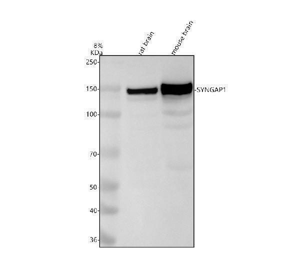 Western blot analysis of SYNGAP1 using anti-SYNGAP1 antibody (M04862)
