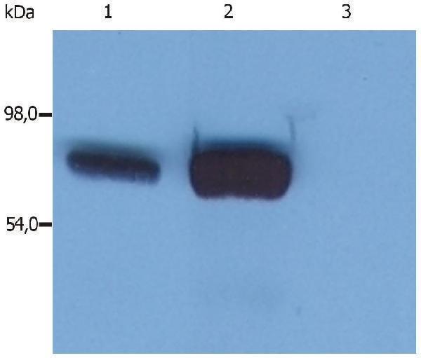 Western blotting analysis (reducing conditions) of whole cell lysate using anti-SLP76 (SLP-76/03)
