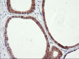 m04881 anti rgs16 mouse monoclonal antibody clone id oti4e5 ihc testing 6
