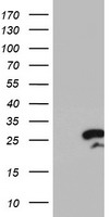 HEK293T cells were transfected with the pCMV6-ENTRY control (Left lane) or pCMV6-ENTRY RGS16 (Right lane) cDNA for 48 hrs and lysed