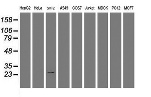 Western blot analysis of extracts (35ug) from 9 different cell lines by using anti-RGS16 monoclonal antibody