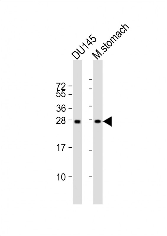 All lanes : Anti-RAB27B Antibody at 1:2000 dilutionLane 1: DU145 whole cell lysateLane 2: mouse stomach lysateLysates/proteins at 20 µg per lane