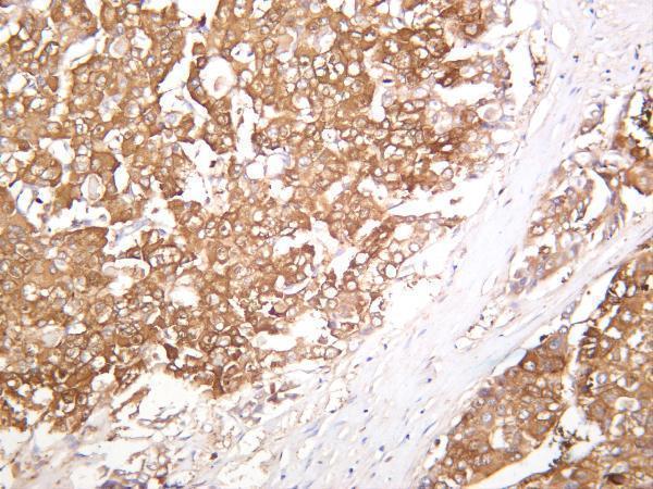 m04899 2 bbc3 primary antibodies ihc testing 1