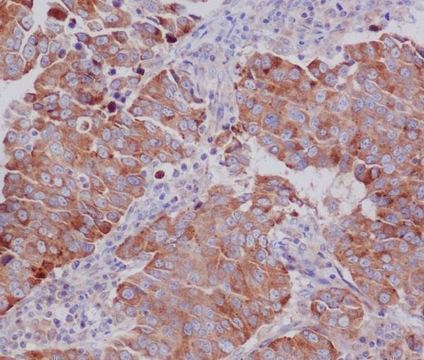 m04899 bbc3 primary antibodies ihc testing 2