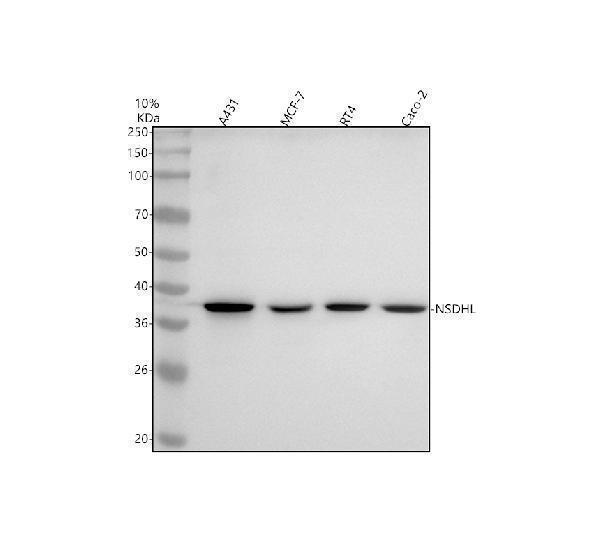  Western blot analysis of NSDHL using anti-NSDHL antibody (M04902-1)