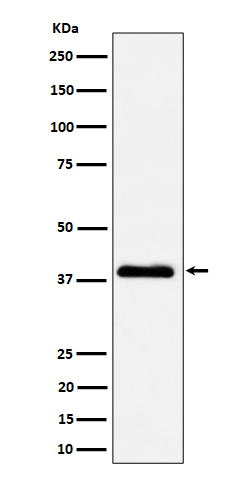 Western blot analysis of NSDHL expression in A431 cell lysate