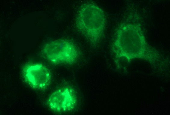m04908 anti herpud1 mouse monoclonal antibody clone id oti1a2 if testing 8