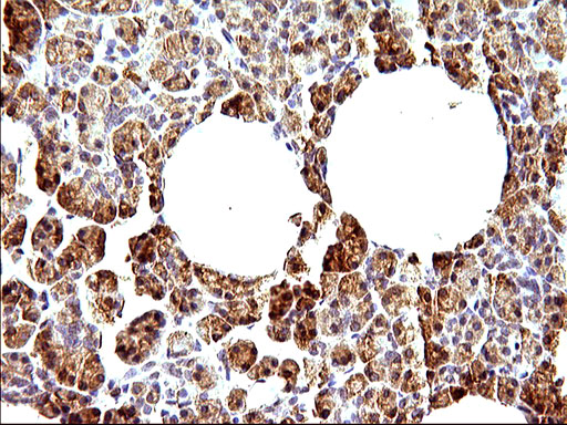 Immunohistochemical staining of paraffin-embedded Human pancreas tissue within the normal limits using anti-HERPUD1 mouse monoclonal antibody