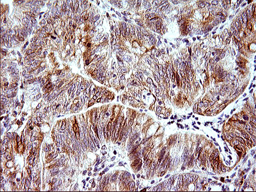 m04908 anti herpud1 mouse monoclonal antibody clone id oti1a2 ihc testing 4