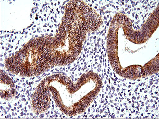 m04908 anti herpud1 mouse monoclonal antibody clone id oti1a2 ihc testing 5