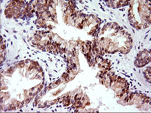 m04908 anti herpud1 mouse monoclonal antibody clone id oti1a2 ihc testing 6