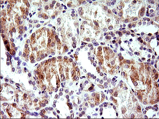 m04908 anti herpud1 mouse monoclonal antibody clone id oti1a2 ihc testing 7