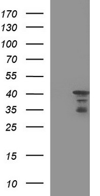 HEK293T cells were transfected with the pCMV6-ENTRY control (Left lane) or pCMV6-ENTRY HERPUD1 (Right lane) cDNA for 48 hrs and lysed