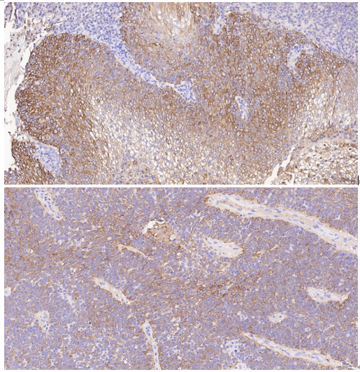 IHC analysis of SLC22A3 using anti-SLC22A3 antibody (M04914)