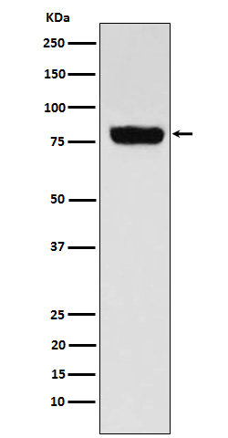 Western blot analysis of SLC22A3 expression in Human muscle cell lysate
