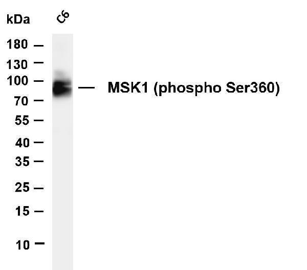 m04922 1 rps6ka5 primary antibodies wb testing 1