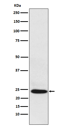Western blot analysis of BAG2 expression in HepG2 cell lysate