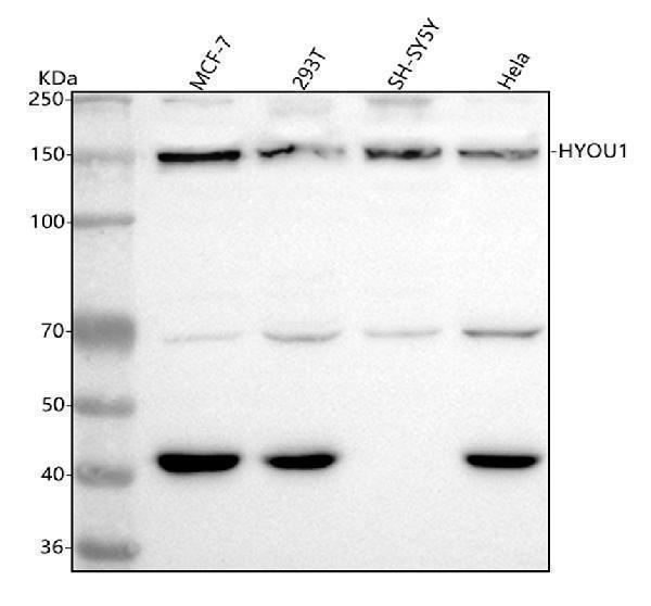  Western blot analysis of ORP150 using anti-ORP150 antibody (M04934-2)