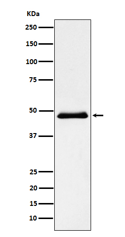Western blot analysis of Pancreatic Lipase (PNLIP) expression in Human pancreas lysate